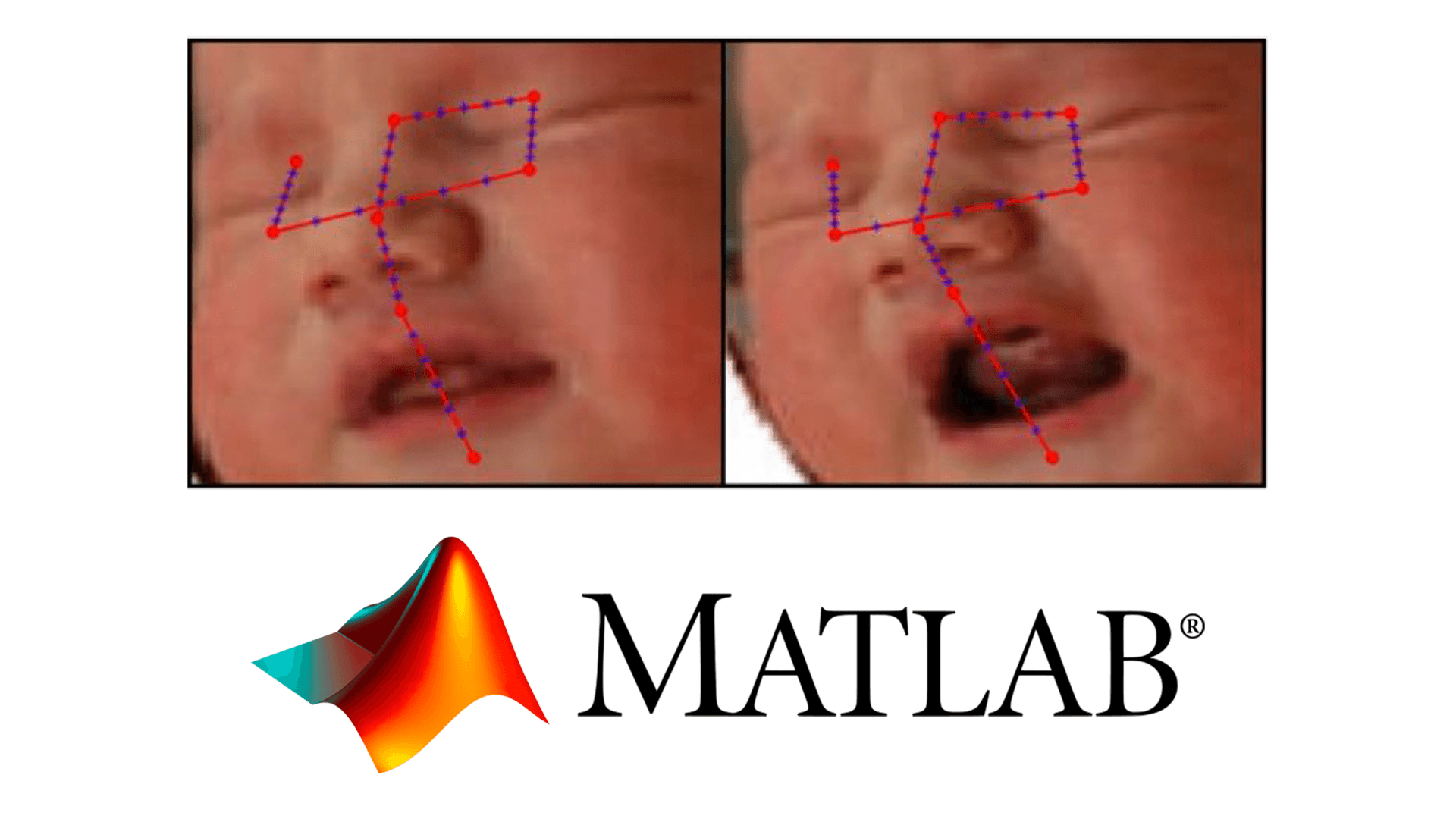 AI-based neonatal facial recognition